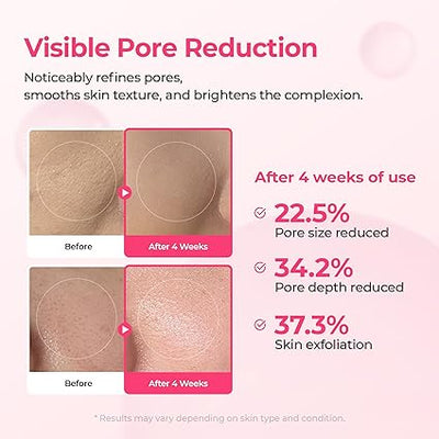 Virella® Lumi Pore & Spot Care Serum Duo