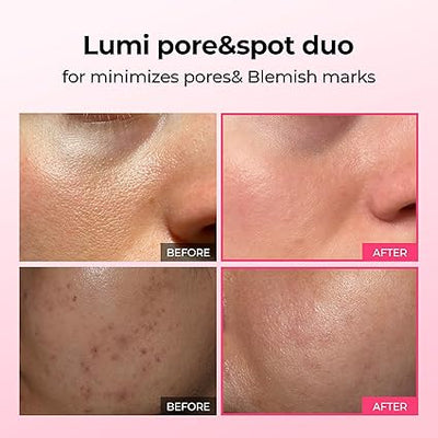 Virella® Lumi Pore & Spot Care Serum Duo